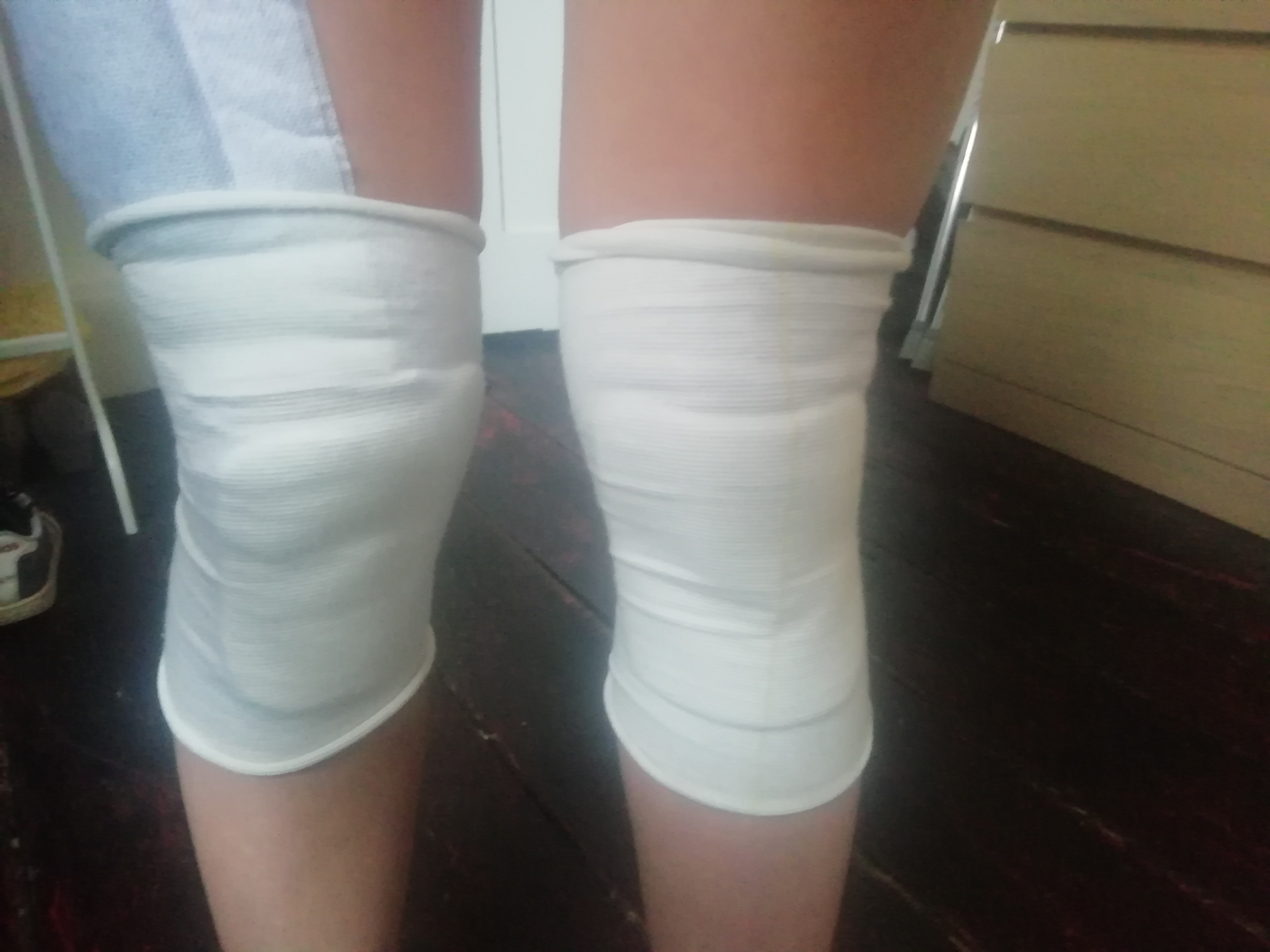 Blog about knee skingraft